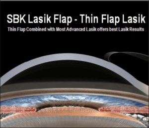 Lasik in Pune